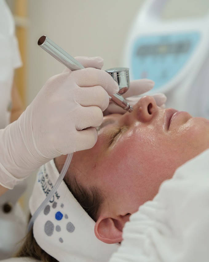 Gesichtsbehandlungen bei Nativis Beauty Oase
